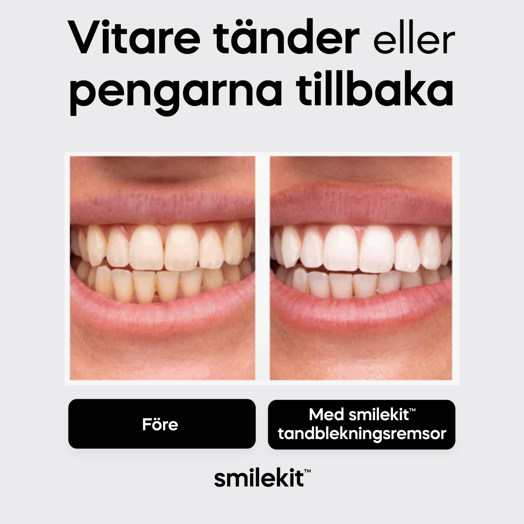 smilekit™ Charcoal Tandblekningsremsor